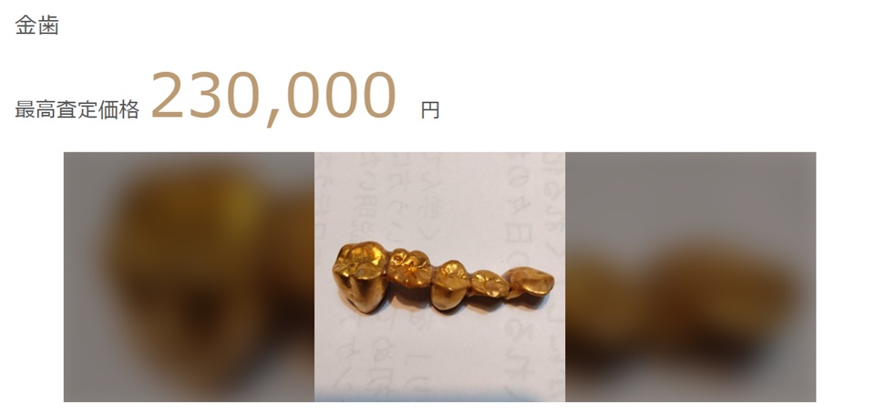 ウリドキ金歯画像