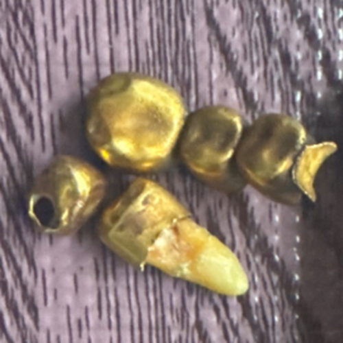 金歯