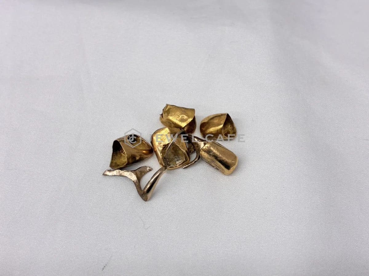 金歯