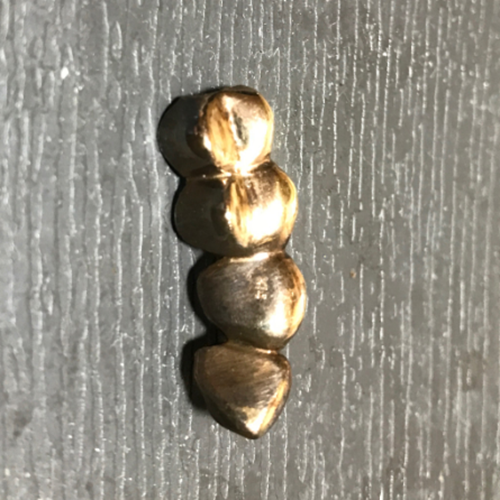 金歯