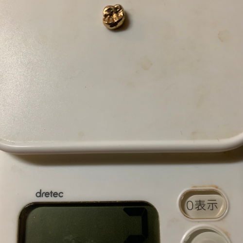 金歯クラウンとブリッジ（歯付）