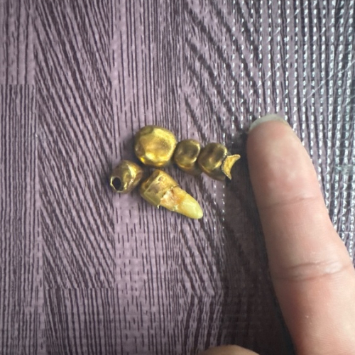 金歯