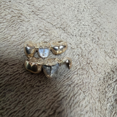 金歯