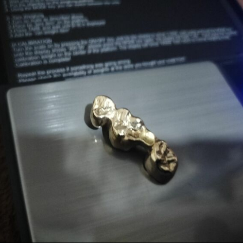 金歯