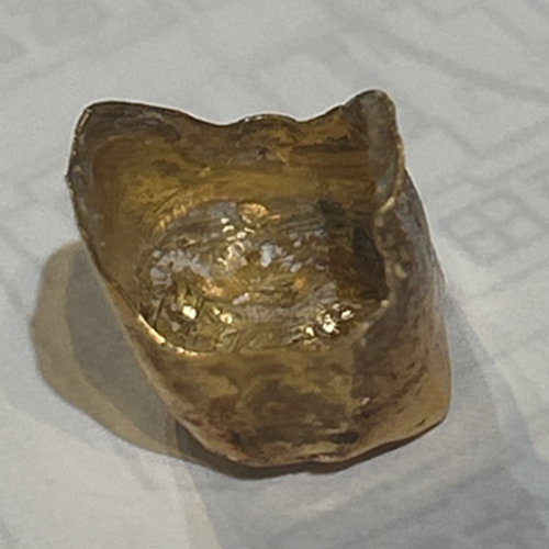 金歯