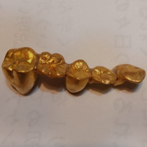 金歯