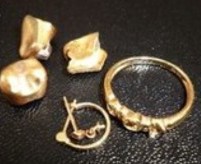 金歯と石のとれた指輪・ピアス