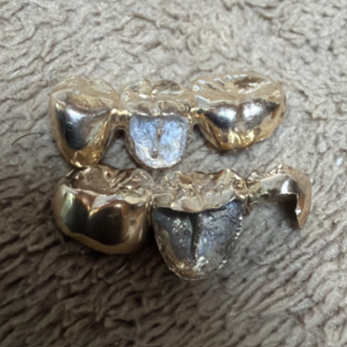 金歯