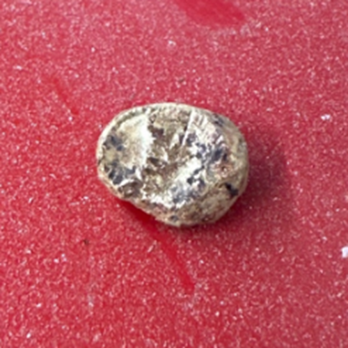 金歯