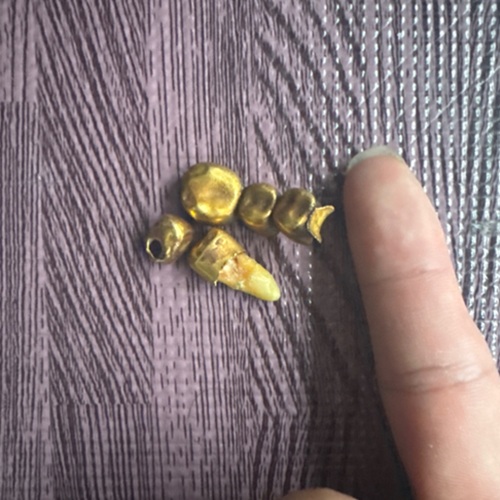 金歯