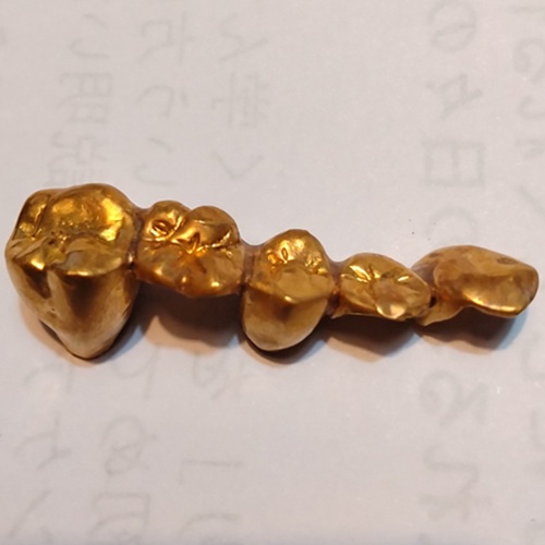 金歯