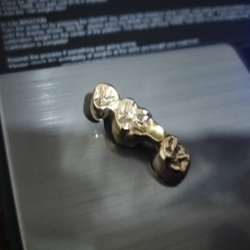 金歯
