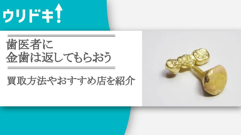 歯医者に金歯は返してもらおう｜買取方法やおすすめ店を紹介 - ウリドキ