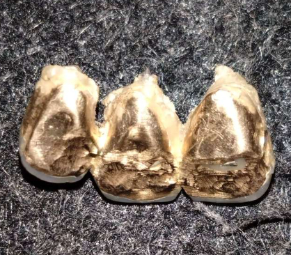 金、プラチナ、銅の合金