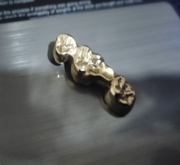 金歯