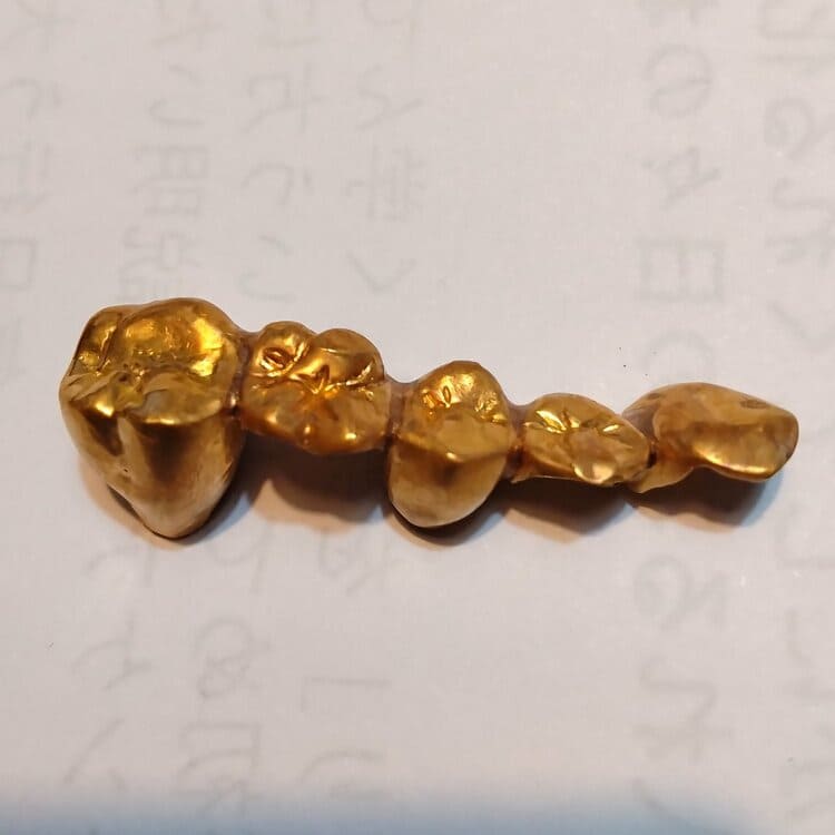 金歯